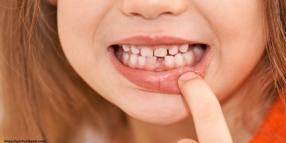 Spiritual Meaning Of Losing Teeth In A Dream
